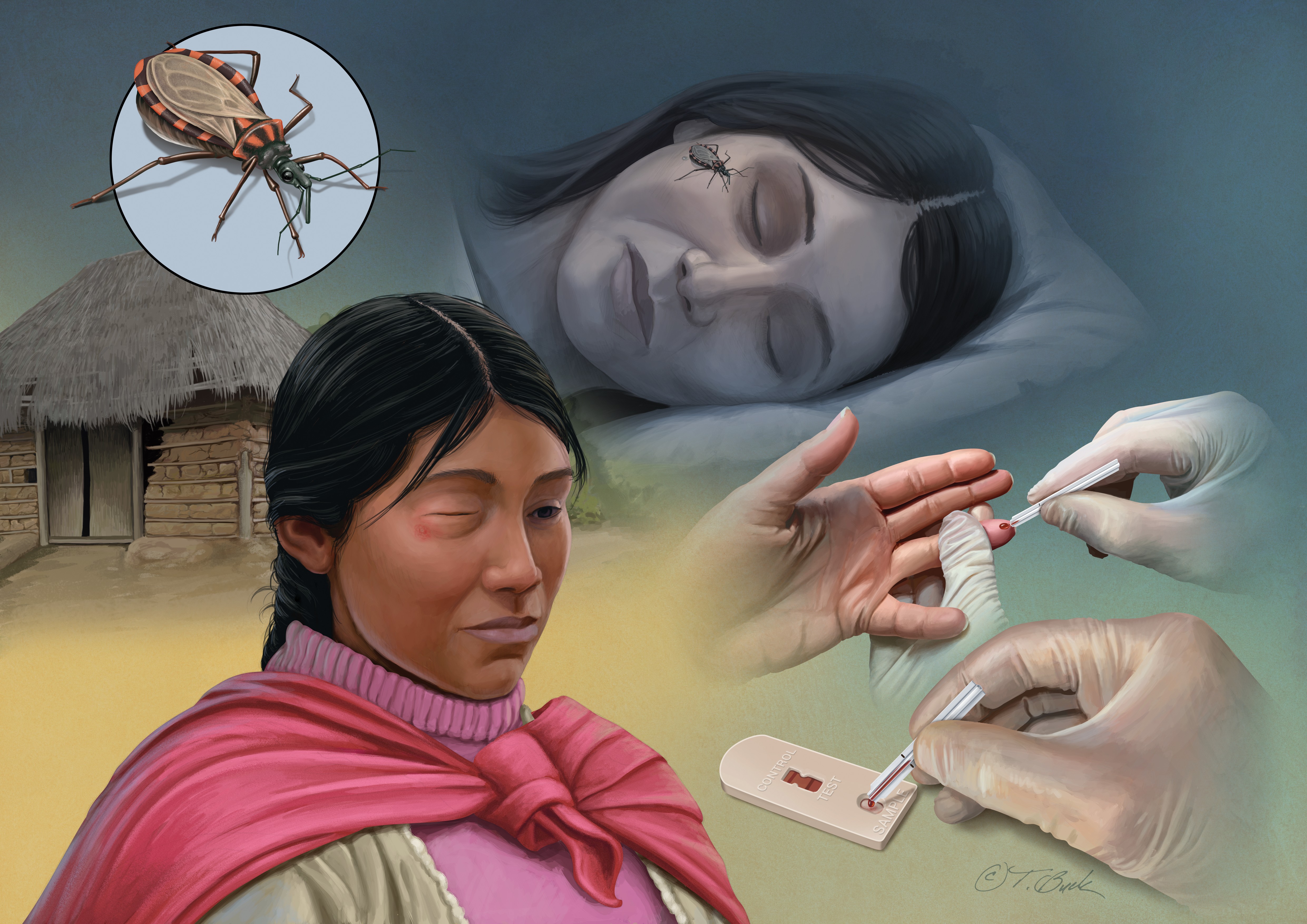 Chagas illustration